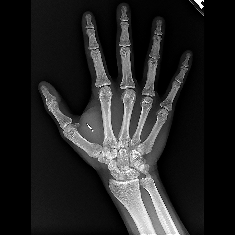 RFID tag in my right hand